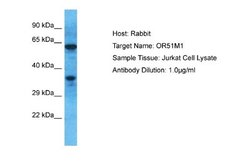 OR51M1 Rabbit anti-Human, Polyclonal, Novus Biologicals 0.1 mL | Buy Online | Novus Biologicals | Fisher Scientific